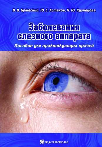 Заболевания слезного аппарата